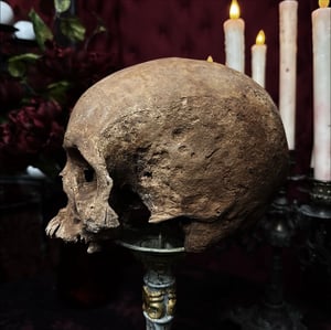 Image of Male Human Skull