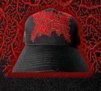 Image 1 of Viscera Infest-Verrucous Carcinoma