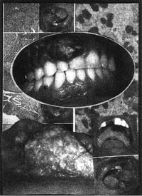 Image 1 of Gonococcus - sessions #10 - 15