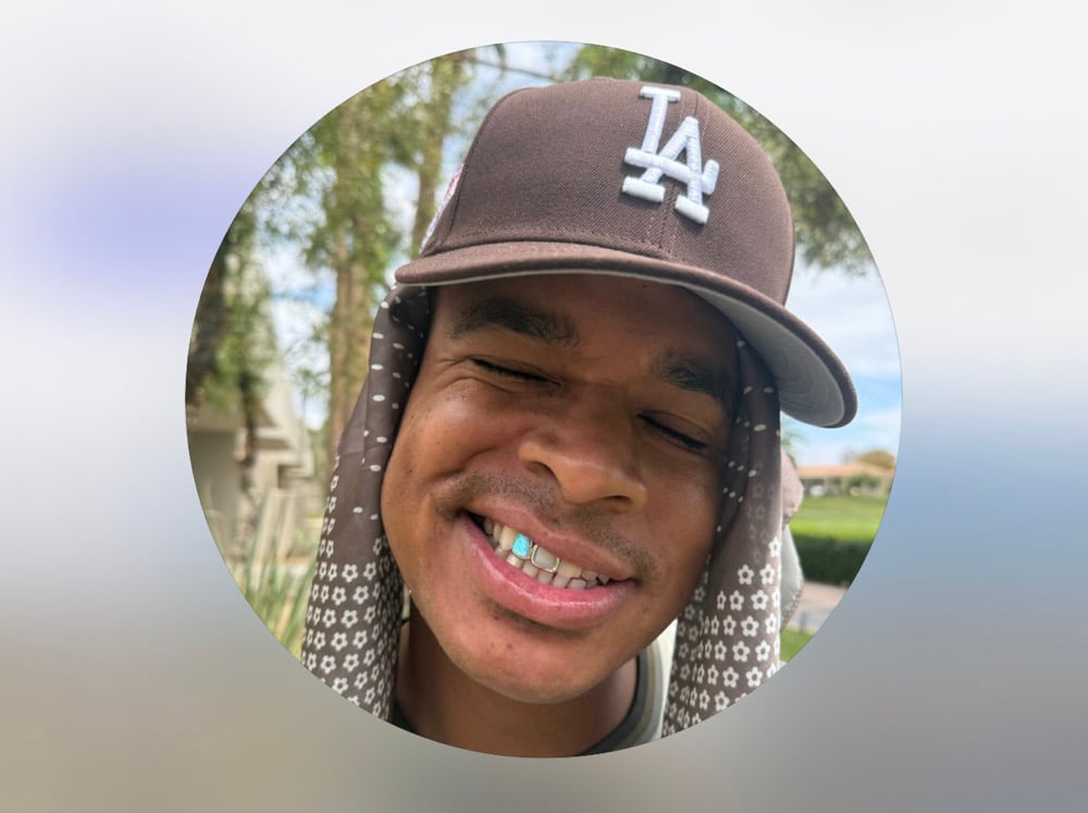 Image of 2 teeth grillz with one Opal 10k yellow gold 