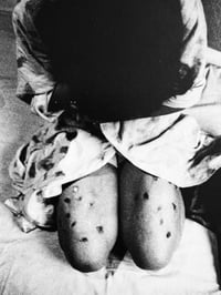 Image 8 of Kazuo Kenmochi "This is Drugs: A Photographic Look at the Roots of Modern Diseases"