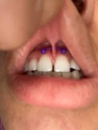 Image of Smiley 😃 piercings 