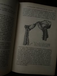 Image 10 of Précis de pathologie médicale, 2 tomes, collection de precis médicaux Masson, 1920