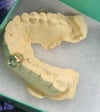 Custom Mold Appointment