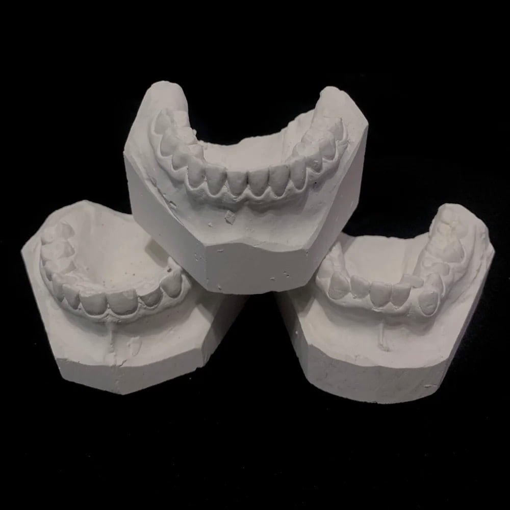 Image of Dental Mold 