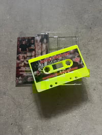 Image 3 of Artery Eruption Gouging Out Eyes of Mutilated Infants tape