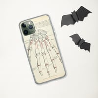 Image 5 of Antique Bookpage Detailed Anatomical Illustration Human Hand Clear Case for iPhone®