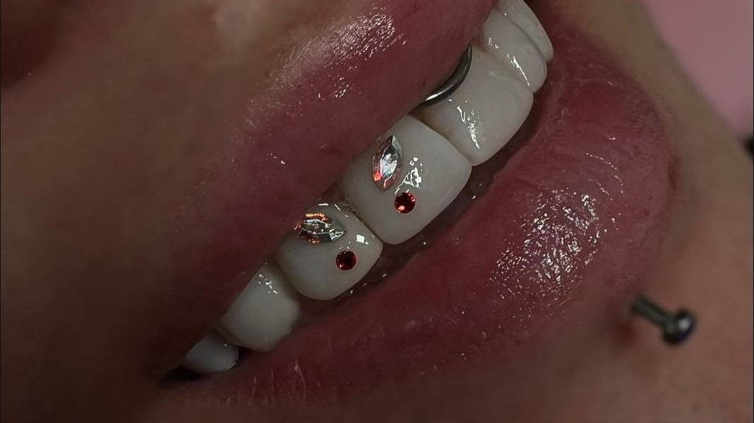 Slideshow image 7