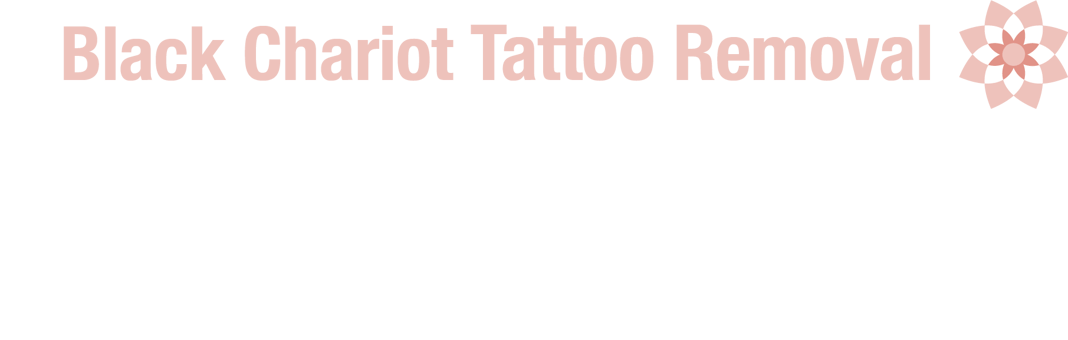 Black Chariot Tattoo Removal Home